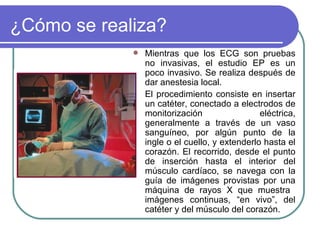 ¿Cómo se realiza? Mientras que los ECG son pruebas no invasivas, el estudio EP es un poco invasivo. Se realiza después de dar anestesia local.  El procedimiento consiste en insertar un catéter, conectado a electrodos de monitorización eléctrica, generalmente a través de un vaso sanguíneo, por algún punto de la ingle o el cuello, y extenderlo hasta el corazón. El recorrido, desde el punto de inserción hasta el interior del músculo cardíaco, se navega con la guía de imágenes provistas por una máquina de rayos X que muestra  imágenes continuas, “en vivo”, del catéter y del músculo del corazón.  