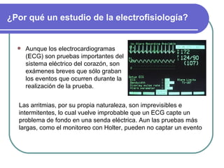 ¿Por qué un estudio de la electrofisiología? Aunque los electrocardiogramas (ECG) son pruebas importantes del sistema eléctrico del corazón, son exámenes breves que sólo graban los eventos que ocurren durante la realización de la prueba. Las arritmias, por su propia naturaleza, son imprevisibles e intermitentes, lo cual vuelve improbable que un ECG capte un problema de fondo en una senda eléctrica. Aun las pruebas más largas, como el monitoreo con Holter, pueden no captar un evento 
