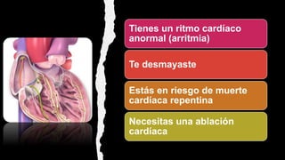 Tienes un ritmo cardíaco
anormal (arritmia)
Te desmayaste
Estás en riesgo de muerte
cardíaca repentina
Necesitas una ablación
cardíaca
 