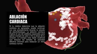ABLACIÓN
CARDIACA
Si tu médico determina que la ablación
cardíaca es apropiada, puede continuar
con ese procedimiento durante tu estudio
de electrofisiología. La ablación cardíaca
implica el uso de catéteres especiales para
aplicar energía de calor o frío a áreas de tu
corazón. La energía crea tejido cicatricial
que bloquea las señales de actividad
eléctrica anormal para restaurar un ritmo
cardíaco normal.
 