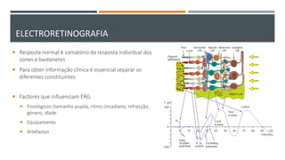 ELECTRORETINOGRAFIA
 Resposta normal é somatório da resposta individual dos
cones e bastonetes
 Para obter informação clínica é essencial separar os
diferentes constituintes
 Factores que influenciam ERG:
 Fisiológicos (tamanho pupila, ritmo circadiano, refracção,
género, idade
 Equipamento
 Artefactos
 