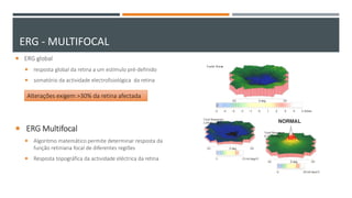  ERG global
 resposta global da retina a um estímulo pré-definido
 somatório da actividade electrofisiológica da retina
 ERG Multifocal
 Algoritmo matemático permite determinar resposta da
função retiniana focal de diferentes regiões
 Resposta topográfica da actividade eléctrica da retina
Alterações exigem >30% da retina afectada
ERG - MULTIFOCAL
 