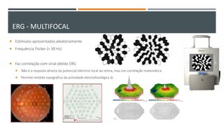  Estímulos apresentados aleatoriamente
 Frequência Flicker (> 30 Hz)
 Faz correlação com sinal obtido ERG
 Não é a resposta directa do potencial eléctrico local da retina, mas sim correlação matemática
 Permite medida topográfica da actividade electrofisiológica da retina
ERG - MULTIFOCAL
 