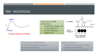 Traçado típico mfERG
Onda bi-fásica
1ª deflecção negativa- N1
2º pico positivo- P1
p/ vezes deflecção
negativa- N2
ERG - MULTIFOCAL
mf-ERG é complemento ERG full-field
não é útil suspeita patologia pan-retiniana
não útil patologia bastonetes
identifica alterações retinianas até camada nuclear interna
Aplicações diagnósticas:
Avaliação das camadas externas da retina
Complemento ERG full-field
Pode ser complementado ERG Pattern
 