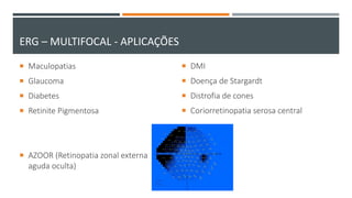  Maculopatias
 Glaucoma
 Diabetes
 Retinite Pigmentosa
 AZOOR (Retinopatia zonal externa
aguda oculta)
 DMI
 Doença de Stargardt
 Distrofia de cones
 Coriorretinopatia serosa central
ERG – MULTIFOCAL - APLICAÇÕES
 