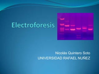 Electroforesis Nicolás Quintero Soto UNIVERSIDAD RAFAEL NUÑEZ 