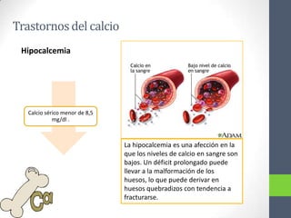 Trastornos del calcio
 Hipocalcemia




   Calcio sérico menor de 8,5
             mg/dl .



                                La hipocalcemia es una afección en la
                                que los niveles de calcio en sangre son
                                bajos. Un déficit prolongado puede
                                llevar a la malformación de los
                                huesos, lo que puede derivar en
                                huesos quebradizos con tendencia a
                                fracturarse.
 