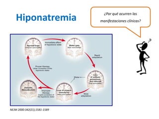 NEJM 2000:342(21);1581-1589 
Hiponatremia 
¿Por qué ocurren las manifestaciones clínicas?  