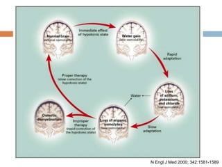 N Engl J Med 2000; 342:1581-1589
 