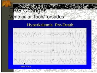 EKG Changes
Ventricular Tach/Torsades
 