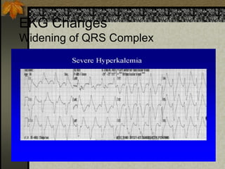 EKG Changes
Widening of QRS Complex
 