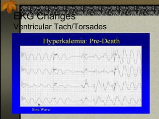 EKG Changes
Ventricular Tach/Torsades
 