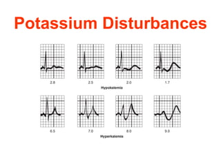 Potassium Disturbances 