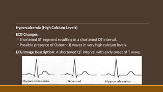 Comprehensive Overview of Electrolyte Disturbances and Cardiac Effects ...