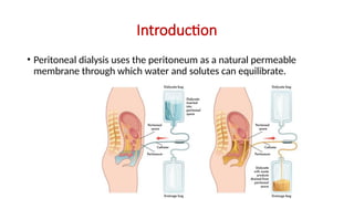 Introduction
• Peritoneal dialysis uses the peritoneum as a natural permeable
membrane through which water and solutes can equilibrate.
 