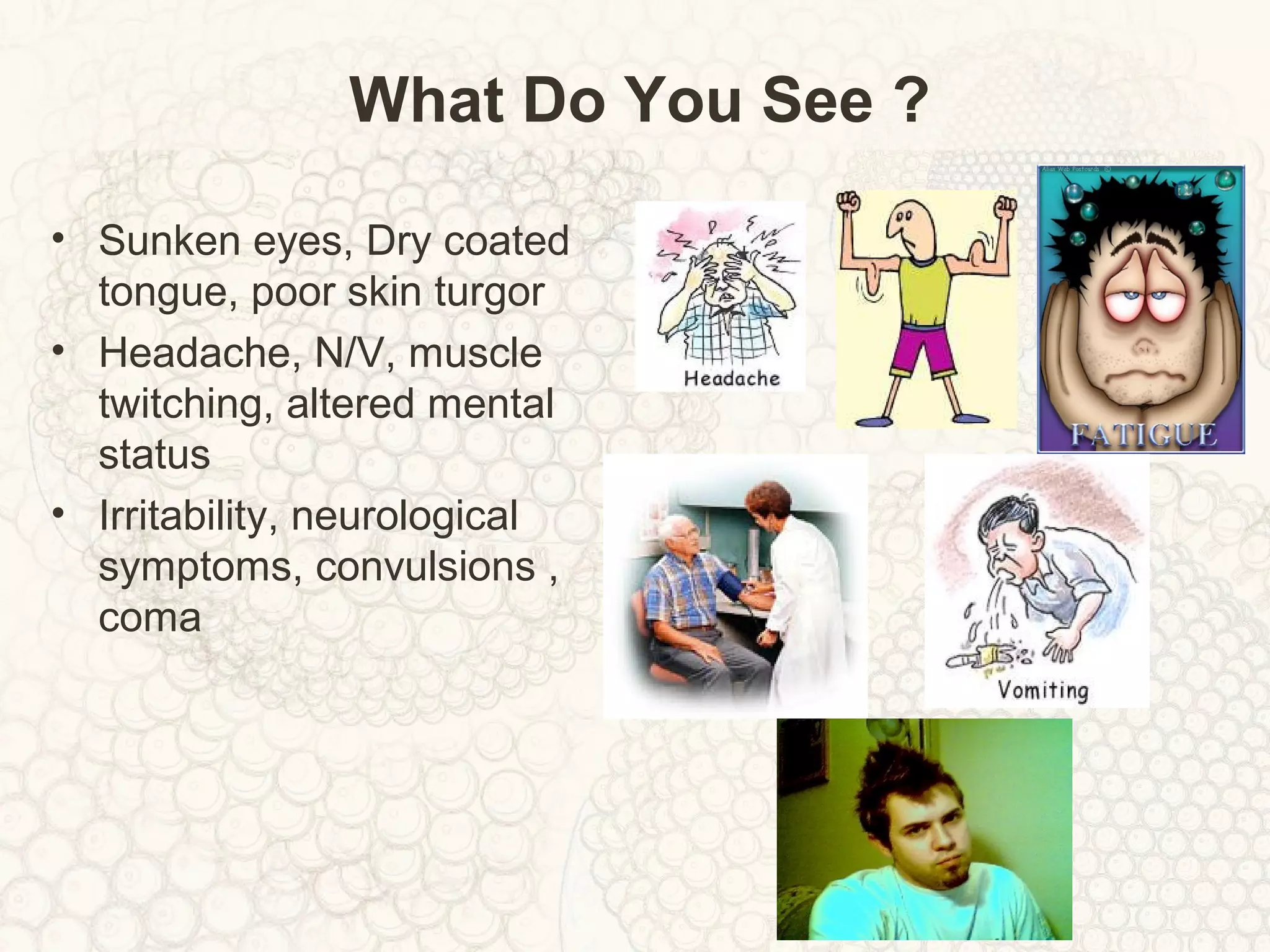 What Do You See ?
• Sunken eyes, Dry coated
tongue, poor skin turgor
• Headache, N/V, muscle
twitching, altered mental
status
• Irritability, neurological
symptoms, convulsions ,
coma
 