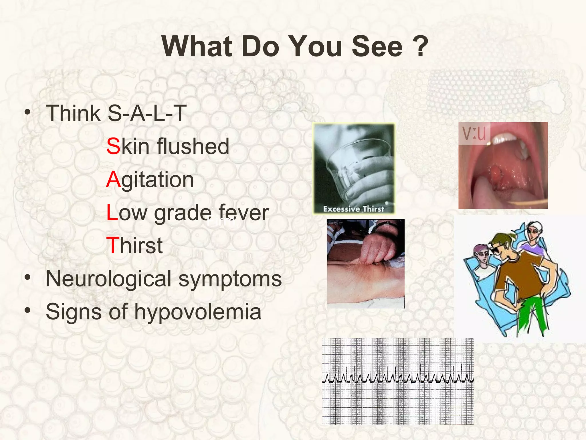 What Do You See ?
• Think S-A-L-T
Skin flushed
Agitation
Low grade fever
Thirst
• Neurological symptoms
• Signs of hypovolemia
Firm,
 