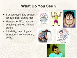 What Do You See ?
• Sunken eyes, Dry coated
tongue, poor skin turgor
• Headache, N/V, muscle
twitching, altered mental
status
• Irritability, neurological
symptoms, convulsions ,
coma
 
