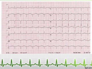 Potassium level of 1.5
 