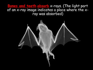 Bones and teeth absorb x-rays. (The light part
of an x-ray image indicates a place where the x-
ray was absorbed)
 