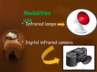 Modalities
use
• Infrared lamps
• Digital infrared camera
 