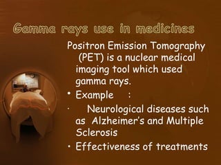 Positron Emission Tomography
(PET) is a nuclear medical
imaging tool which used
gamma rays.
• Example :
• Neurological diseases such
as Alzheimer’s and Multiple
Sclerosis
• Effectiveness of treatments
 