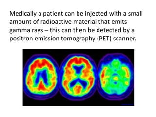 Medically a patient can be injected with a small 
amount of radioactive material that emits 
gamma rays – this can then be detected by a 
positron emission tomography (PET) scanner. 
www.geripal.org 
 