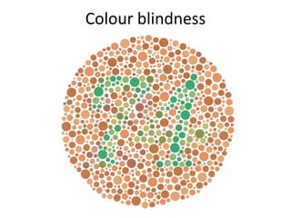 Colour blindness 
 