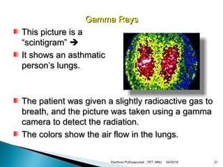 Gamma RaysGamma Rays
This picture is aThis picture is a
“scintigram”“scintigram” 
It shows an asthmaticIt shows an asthmatic
person’s lungs.person’s lungs.
The patient was given a slightly radioactive gas toThe patient was given a slightly radioactive gas to
breath, and the picture was taken using a gammabreath, and the picture was taken using a gamma
camera to detect the radiation.camera to detect the radiation.
The colors show the air flow in the lungs.The colors show the air flow in the lungs.
04/30/18Pavithran Puthiyapurayil , FET, MNU 21
 