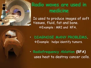 Radio waves are used in
medicine
• Is used to produce images of soft
tissues, fluid, fat and bone.
Example : MRI and RFA.
• DIAGNOSE MANY PROBLEMS.
Example : helps identify tumors.
• Radiofrequency Ablation (RFA)
uses heat to destroy cancer cells.
 