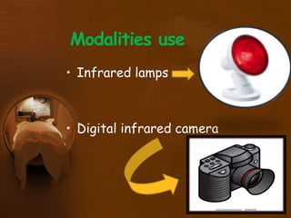 Modalities use
• Infrared lamps
• Digital infrared camera
 