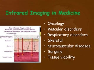 Infrared Imaging in Medicine
• Oncology
• Vascular disorders
• Respiratory disorders
• Skeletal
• neuromuscular diseases
• Surgery
• Tissue viability
 