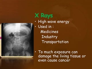 X Rays
• High wave energy
• Used in :
Medicines
Industry
Transportation
• To much exposure can
damage the living tissue or
even cause cancer
 