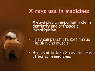 • X-rays play an important role in
dentistry and orthopedic
investigation.
• They can penetrate soft tissue
like skin and muscle.
• Are used to take X-ray pictures
of bones in medicine.
 