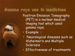 Positron Emission Tomography
(PET) is a nuclear medical
imaging tool which used
gamma rays.
• Example :
• Neurological diseases such as
Alzheimer’s and Multiple
Sclerosis
• Effectiveness of treatments
 