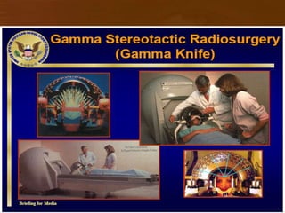 Electromagnetic waves