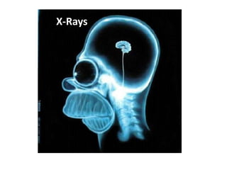 X-RaysX-ray