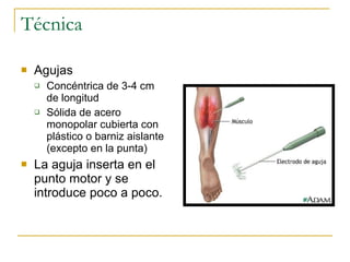 Técnica Agujas Concéntrica de 3-4 cm de longitud Sólida de acero monopolar cubierta con plástico o barniz aislante (excepto en la punta) La aguja inserta en el punto motor y se introduce poco a poco. 