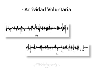 - Actividad VoluntariaBAREA, Rafael. Electromiografía.  Instrumentación Biomédica. Universidad de Alcalá