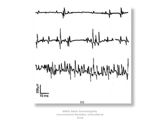 BAREA, Rafael. Electromiografía.  Instrumentación Biomédica. Universidad de Alcalá