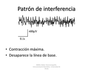 Patrón de interferenciaContracción máxima.Desaparece la línea de base.BAREA, Rafael. Electromiografía.  Instrumentación Biomédica. Universidad de Alcalá