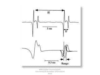 BAREA, Rafael. Electromiografía.  Instrumentación Biomédica. Universidad de Alcalá