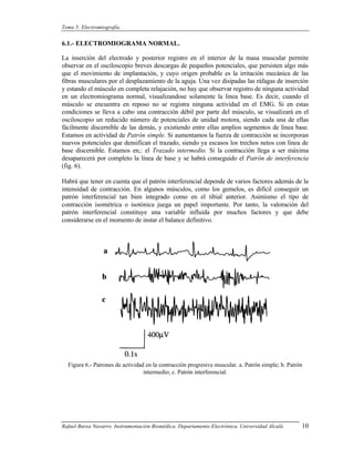 Tema 5: Electromiografía.


6.1.- ELECTROMIOGRAMA NORMAL.

La inserción del electrodo y posterior registro en el interior de la masa muscular permite
observar en el osciloscopio breves descargas de pequeños potenciales, que persisten algo más
que el movimiento de implantación, y cuyo origen probable es la irritación mecánica de las
fibras musculares por el desplazamiento de la aguja. Una vez disipadas las ráfagas de inserción
y estando el músculo en completa relajación, no hay que observar registro de ninguna actividad
en un electromiograma normal, visualizandose solamente la linea base. Es decir, cuando el
músculo se encuentra en reposo no se registra ninguna actividad en el EMG. Si en estas
condiciones se lleva a cabo una contracción débil por parte del músculo, se visualizará en el
osciloscopio un reducido número de potenciales de unidad motora, siendo cada una de ellas
fácilmente discernible de las demás, y existiendo entre ellas amplios segmentos de linea base.
Estamos en actividad de Patrón simple. Si aumentamos la fuerza de contracción se incorporan
nuevos potenciales que densifican el trazado, siendo ya escasos los trechos netos con línea de
base discernible. Estamos en,: el Trazado intermedio. Si la contracción llega a ser máxima
desaparecerá por completo la línea de base y se habrá conseguido el Patrón de interferencia
(fig. 6).

Habrá que tener en cuenta que el patrón interferencial depende de varios factores además de la
intensidad de contracción. En algunos músculos, como los gemelos, es difícil conseguir un
patrón interferencial tan bien integrado como en el tibial anterior. Asimismo el tipo de
contracción isométrica o isotónica juega un papel importante. Por tanto, la valoración del
patrón interferencial constituye una variable influida por muchos factores y que debe
considerarse en el momento de instar el balance definitivo.




  Figura 6.- Patrones de actividad en la contracción progresiva muscular. a. Patrón simple; b. Patrón
                                  intermedio; c. Patrón interferencial.




Rafael Barea Navarro. Instrumentación Biomédica. Departamento Electrónica. Universidad Alcalá.      10
 