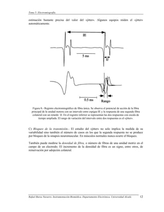 Tema 5: Electromiografía.


estimación bastante precisa del valor del «jitter». Algunos equipos miden el «jitter»
automáticamente.




   Figura 8.- Registro electromiográfico de fibra única. Se observa el potencial de acción de la fibra
  principal de la unidad motora con un intervalo entre espigas IE y la respuesta de una segunda fibra
   colateral con un retardo IJ. En el registro inferior se representan las dos respuestas con escala de
        tiempo ampliada. El rango de variación del intervalo entre dos respuestas es el «jitter».


C) Bloqueo de la transmisión.- El estudio del «jitter» no solo implica la medida de su
variabilidad sino también el número de casos en los que la segunda respuesta no se produce
por bloqueo de la sinapsis neuromuscular. En músculos normales nunca ocurre el bloqueo.

También puede medirse la densidad de fibra, o número de fibras de una unidad motriz en el
campo de un electrodo. El incremento de la densidad de fibra es un signo, entre otros, de
reinervación por adopción colateral.




Rafael Barea Navarro. Instrumentación Biomédica. Departamento Electrónica. Universidad Alcalá.            12
 