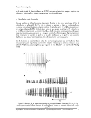 Tema 5: Electromiografía.


en la enfermedad de Lambert-Eaton, el PAMC después del ejercicio adquiere valores mas
próximos a los normales o incluso puede superar los valores iniciales.


b) Estimulación a alta frecuencia.

En este análisis se utiliza la misma disposición descrita en los casos anteriores, si bien la
estimulación se aplica a 20 Hz. Con ésto el músculo se tetaniza, es decir, se contrae de forma
sostenida con realización de un esfuerzo máximo. Se estudian entre 60 y 120 estimulaciones y
sus correspondientes PAMC. En individuos sanos la respuesta a los primeros 60 estímulos no
se modifica o se incrementa levemente (fig. 12.A). En la miastenia comienza reduciéndose para
luego incrementarse, aunque nunca se consiguen los niveles obtenidos para el primer estímulo.
Este incremento es debido en parte a la pseudo facilitación y en parte a una auténtica
facilitación que sigue a la activación repetitiva de las uniones neuromusculares.

En el síndrome de Lambert-Eaton todas las respuestas presentan una amplitud muy baja,
aunque se producen importantes incrementos entre los primeros y los últimos estímulos. En el
estímulo A120 se alcanzan amplitudes que superan en mas del 300% a la amplitud de A1 (fig.
12.B).




  Figura 12.-. Registro de las respuestas obtenidas por estimulación a alta frecuencia (20 Hz). A. En
 condiciones normales. B. En el síndrome de Lambert-Eaton. Tengase en cuenta la diferencia de escala
                                                en mV.
Rafael Barea Navarro. Instrumentación Biomédica. Departamento Electrónica. Universidad Alcalá.     18
 