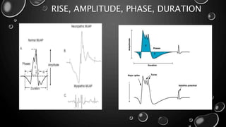 RISE, AMPLITUDE, PHASE, DURATION
 