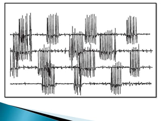 Electromyography (EMG) Basics | PPTX
