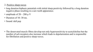 2. Positive sharp waves
• long duration biphasic potentials with initial sharp positivity followed by a long duration
negative phase resulting in a saw tooth appearance.
• amplitude of 20 – 200 µ V
• Duration of 10- 30 ms.
• Sound: dull pop
• The denervated muscle fibres develop not only hypersensitivity to acetylcholine but the
number of ach receptors also increase which leads to depolarization and is responsible
for fibrillation and positive sharp waves.
 