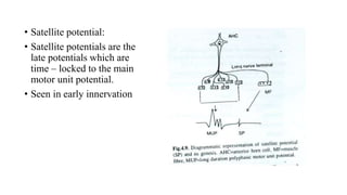 • Satellite potential:
• Satellite potentials are the
late potentials which are
time – locked to the main
motor unit potential.
• Seen in early innervation
 