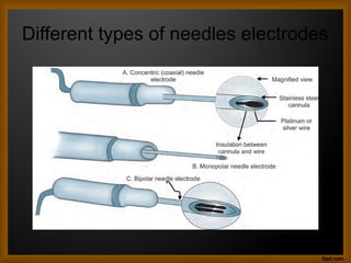 Different types of needles electrodes
 